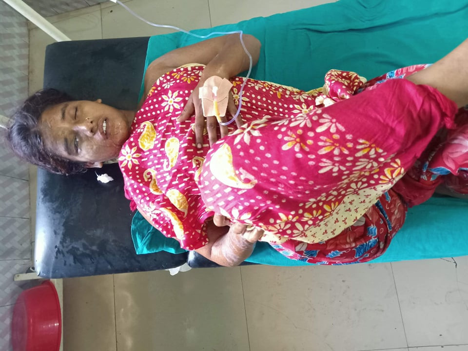 श्रीमती र छोरीमाथि एसिड प्रहार गर्ने पक्राउ